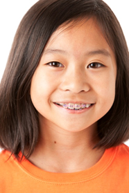 Braces Denver, River North, Englewood, CO Braces Denver, River North, Englewood, CO
