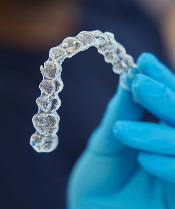 Gloved hand holding clear orthodontic aligner tray for teeth straightening treatment.