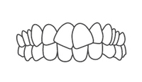 Front view illustration of aligned upper and lower teeth showing proper dental occlusion.