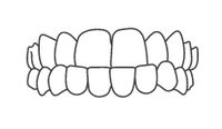 Dental illustration showing straight upper and lower teeth in proper alignment, representing orthodontic treatment results.